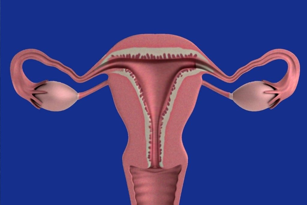 Os sintomas e tratamentos do câncer de ovário
