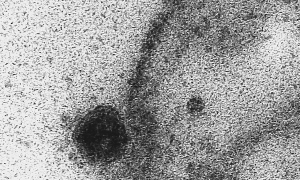 usp:-novo-coronavirus-infecta-e-se-replica-em-glandulas-salivares