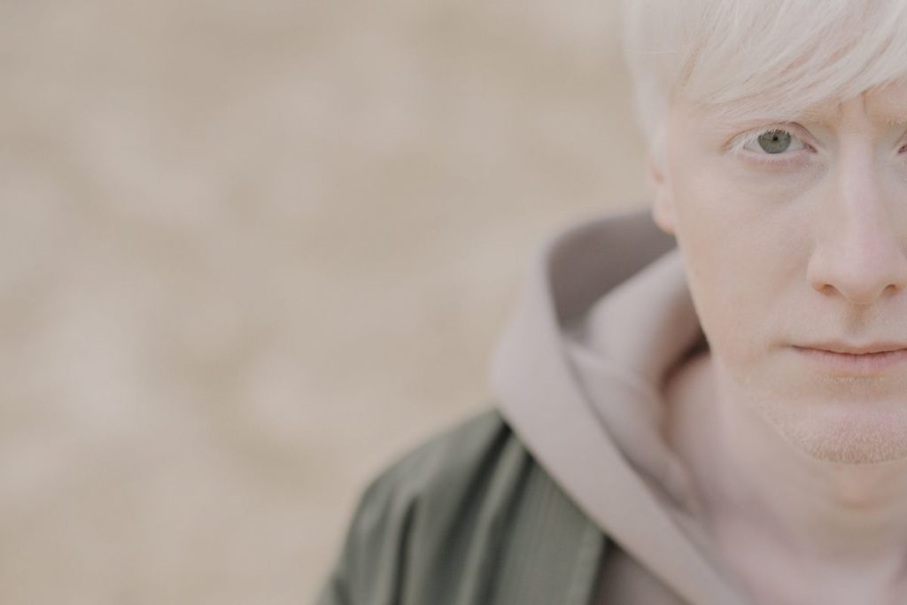 em-10-anos,-85-pessoas-morreram-por-problemas-associados-ao-albinismo
