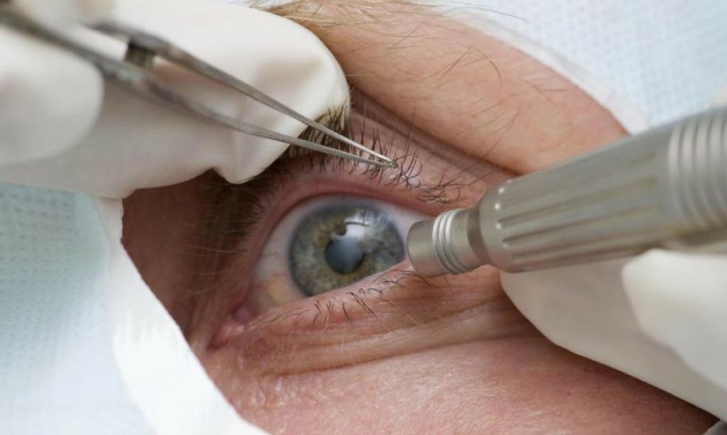 oftalmologistas-oferecem-orientacao-online-sobre-retinopatia-diabetica