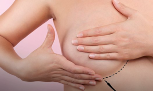mamografias-gratuitas-sao-oferecidas-no-ginasio-do-ibirapuera