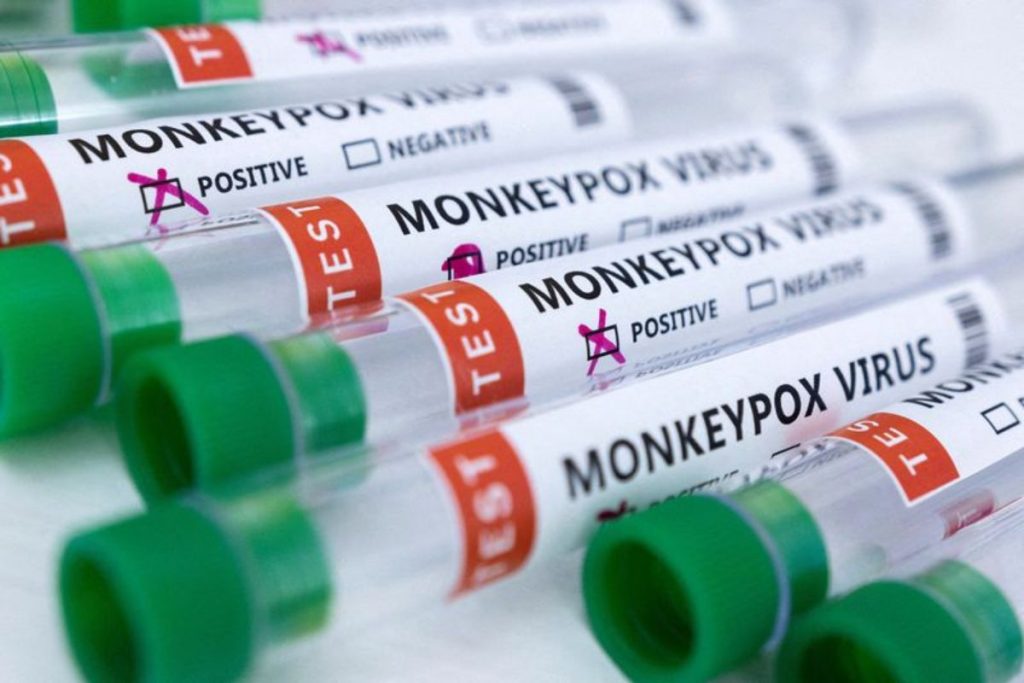 brasil-negocia-compra-de-vacina-contra-variola-dos-macacos