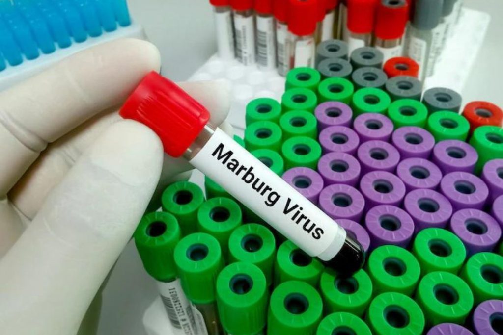 gana-confirma-primeiros-casos-do-virus-marburg