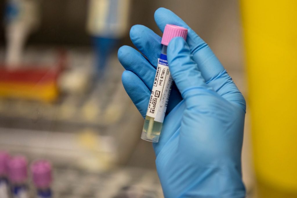 Governo inaugura centro de operação para monitorar varíola dos macacos