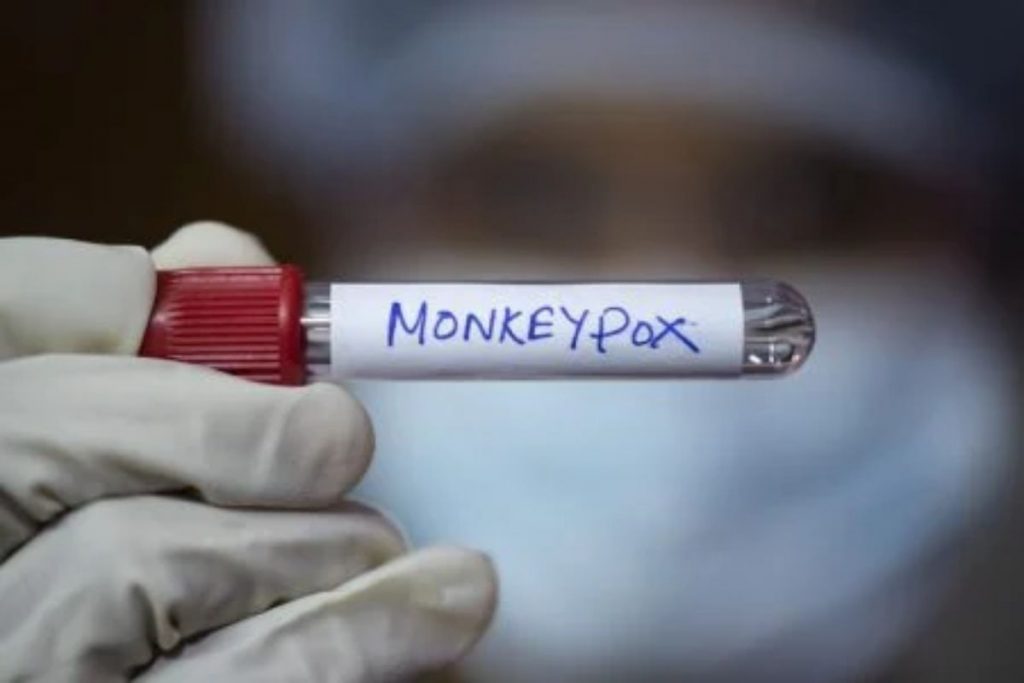 rio-de-janeiro-registra-segunda-morte-por-variola-dos-macacos-no-pais