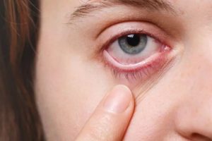 doenca-ocular-relacionada-a-idade-pode-levar-a-cegueira