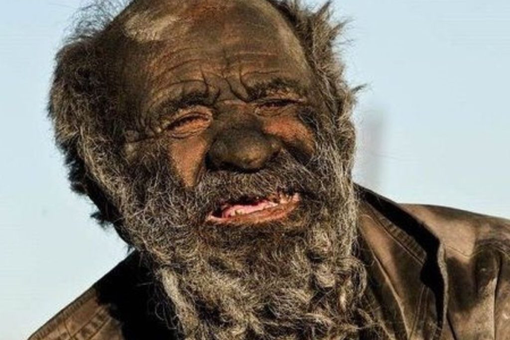 Homem conhecido como 'o mais sujo do mundo' morre depois de banho