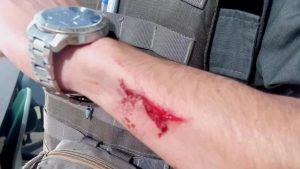 Policial fica ferido após ataque com faca de eleitor