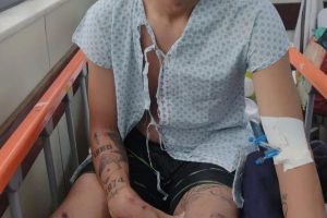 Mãe de jovem que foi agredido por lutadores no Carnaval diz que eles foram 'covardes'
