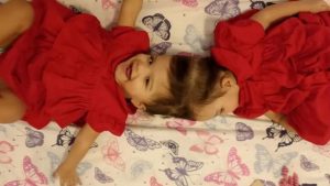 Gêmeas siamesas têm boa evolução após serem separadas em cirurgia, diz hospital