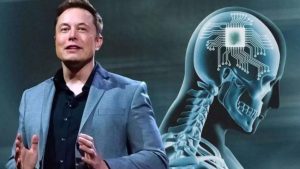 'Neuralink', empresa de Elon Musk, faz 1º implante de chip cerebral em humano