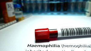 Pessoas com Hemofilia têm uma deficiência ou ausência de certas proteínas de coagulação sanguínea, e isso resulta em sangramento prolongado