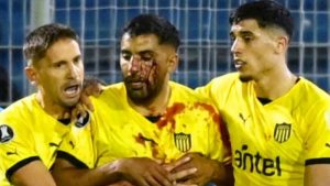 Lateral do Peñarol é atingido por pedra após jogo e se revolta