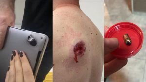 Um motociclista escapou de ferimentos graves após ser baleado durante um assalto no bairro Jaguara, Zona Oeste de São Paulo.