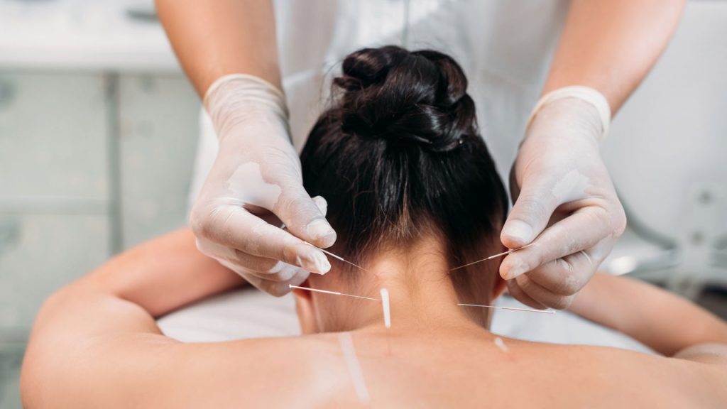 Conheça os benefícios da acupuntura e massagens para a dor de cabeça