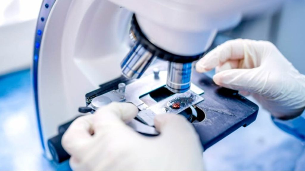 No Dia Mundial do Câncer, especialista faz alerta