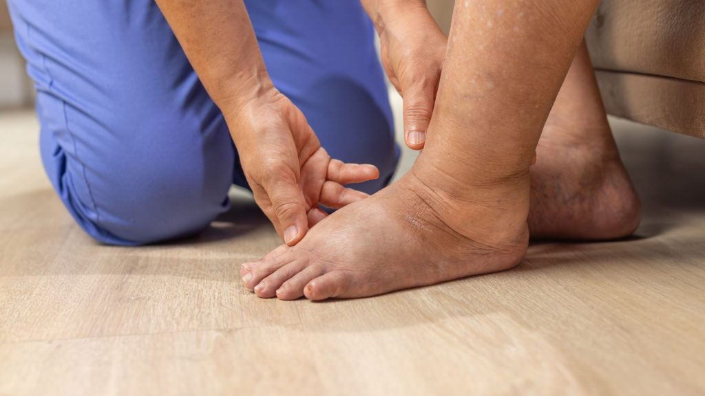 Os rins filtram o sangue continuamente, ajustando a eliminação de sódio e água conforme os sinais hormonais e a pressão dos vasos