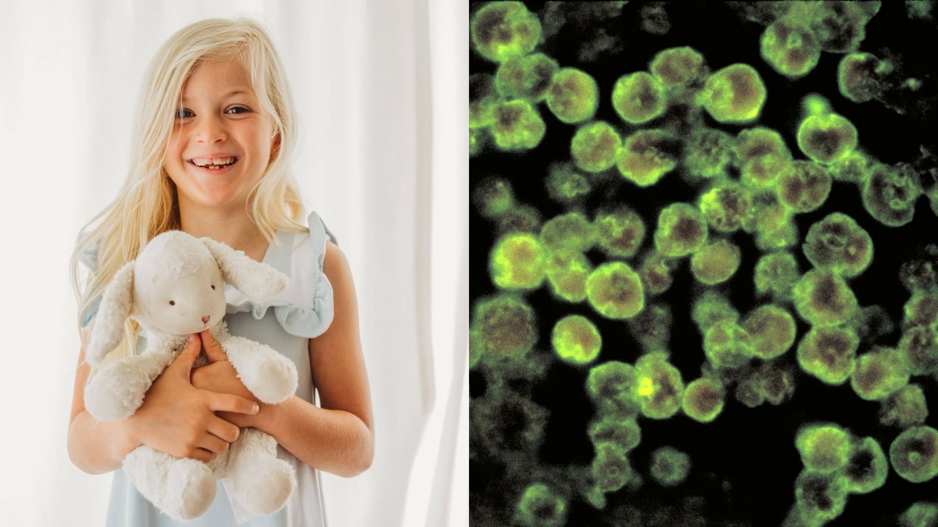Ameba ‘comedora de cérebro’: o que é a infecção que matou menina de 8 anos nos EUA - QTU Questões do Universo