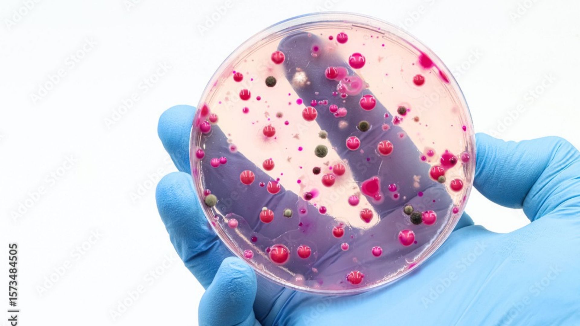 Micotoxinas: pesquisa mundial alerta para riscos na qualidade dos grãos